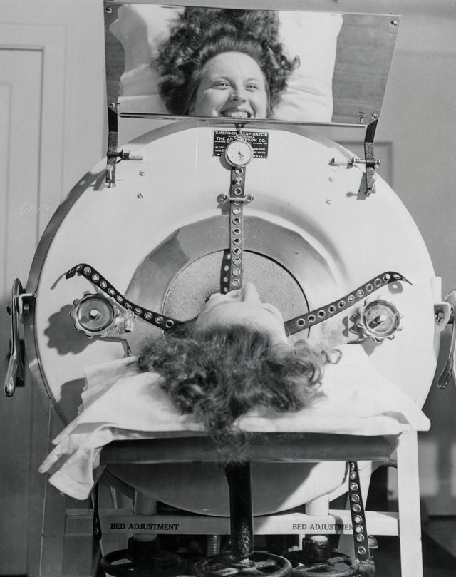 Karen Oaks of Detroit, a polio patient, inside an "iron lung," January 1946. Iron lungs are still used today to help paralysis patients breathe.